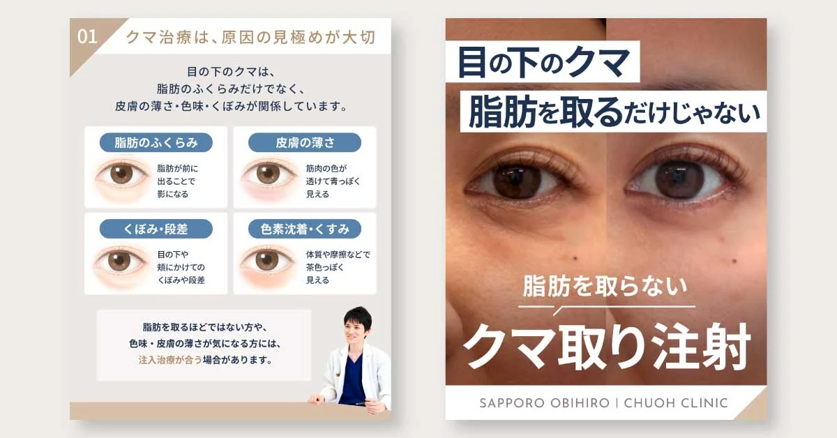 クマ取り注射 SNS投稿用画像